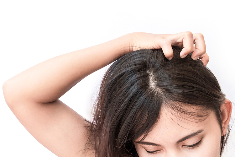 頭皮の乾燥がかゆみの原因？女性におすすめの対処法