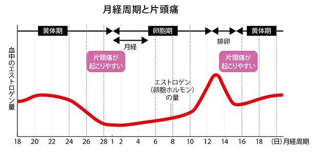 あなたもその頃ですか？月経時片頭痛を和らげる方法を知る